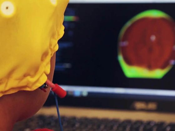 Neurofeedback En Orange County